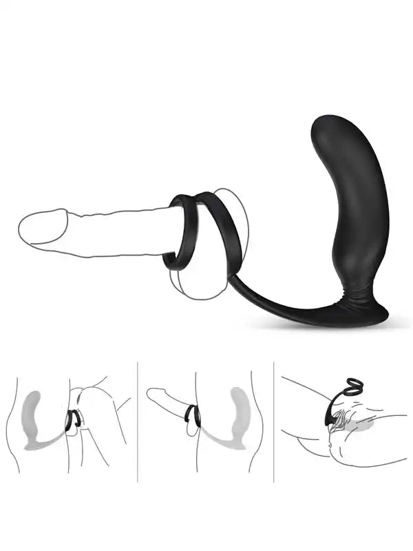 NOXXX Halo Penis Halkalı Prostat ve Şarjlı Anal Masaj Vibratörü - 802167
